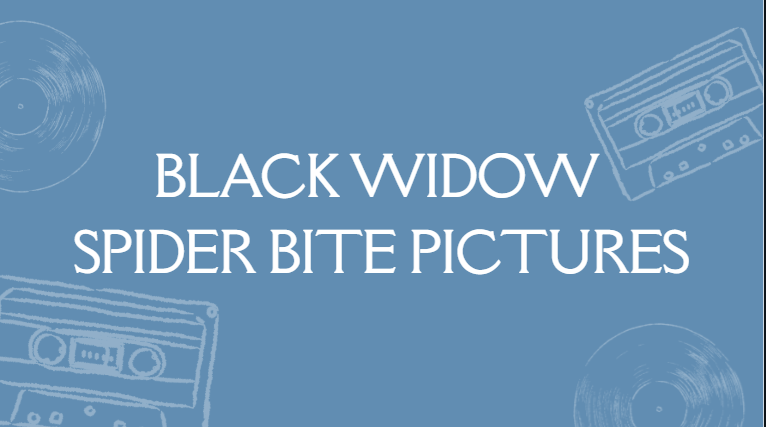 Black Widow Spider Bite Pictures Black Widow Spider Bite Pictures